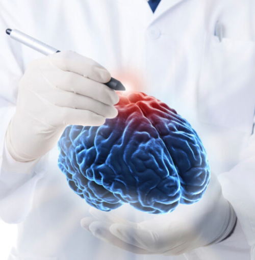 جراحة الأعصاب الوعائية الدموية